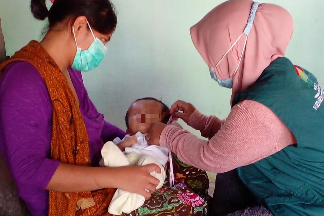 Kemensos Sentuh Anak Hidrosefalus di Lombok dengan ATENSI