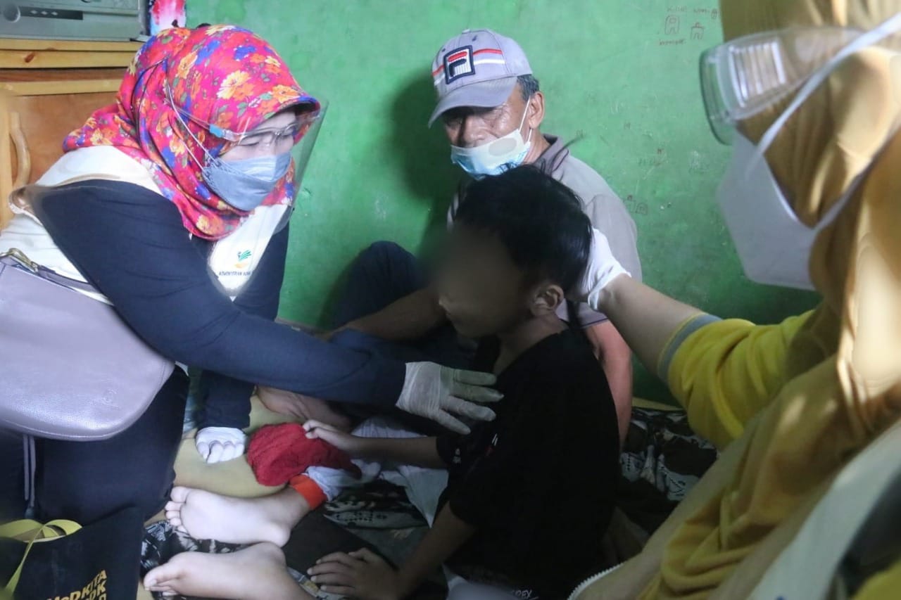 Kemensos Respon Anak dengan Kondisi Suspect Kanker Wajah di Bekasi