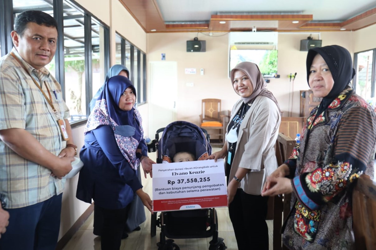 Mensos Kunjungi Anak Pengidap Hidrosefalus di Ngawi